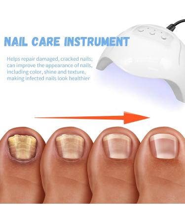Get Rid of Nail Fungus Fast: Mecctuck & Furzero Laser Devices | Effective Nail Fungus Treatment - Buy Online on GoSupps.com