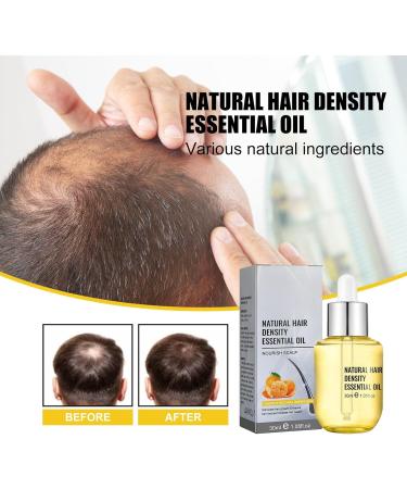 Ginger Hair Serum Natural Ginger Hair Density Oil Ginger Hair Revitalizing Serum Anti Frizz Hair Serum Regenerating Serum for Thinning and - Buy Online on GoSupps.com