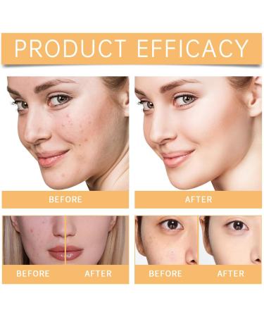 Glycolic Acid Toner 7% Glycolic Acid Toning Resurfacing Solution - Hydrating Exfoliating Toner for Clear and Smooth Skin Reduces Large Pores & Acne Brightens and Strengthens 100ml - Buy Online on GoSupps.com