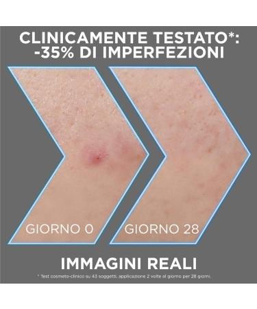 Garnier PureActive Anti-Imperfections Face Serum with Charcoal Niacinamide AHA BHA Treatment Pimples Blackheads Redness Light Mattifying Unifying Formula Without Residue - 2 Bottles of 30ml - Buy Online on GoSupps.com