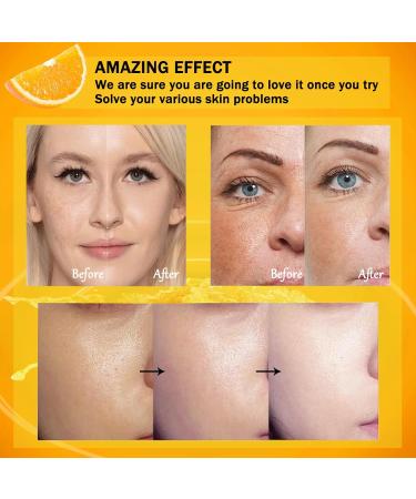 Moisturizing Face Skin Care Gift Set for Women Girls (Vitamin C) - Buy Online on GoSupps.com