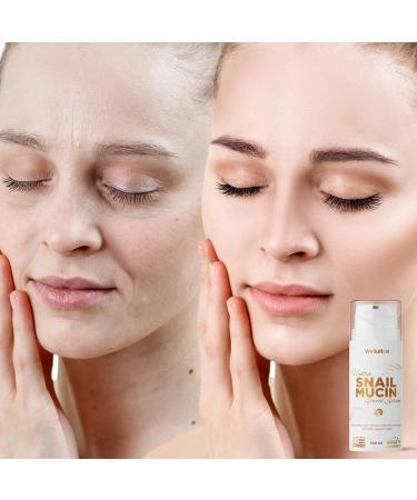 WELLUTION Snail Mucin Hydra Facial Serum - Hydrating Hyaluronic Acid & Aloe Vera - Korean Skincare - 3.4oz - International Shipping Available - Buy Online on GoSupps.com