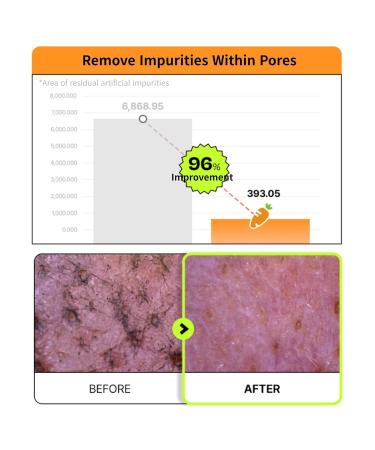 EDIT.B Joyfull Carrot Foaming Gel Cleanser Gentle Deep Pore Cleansing Face Wash Removes Makeup Impurities Sebum Blackheads & Whiteheads Non-Drying Daily Korean Skincare 5.07 fl.oz / 150ml - Buy Online on GoSupps.com
