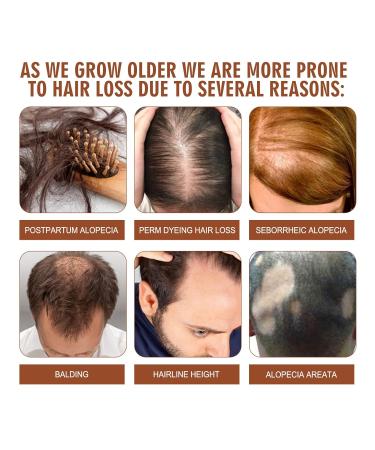 Natural Raw Batana Oil for Hair Growth | 100% Unrefined Prevents Hair Loss Increases Shine | Sourced from Honduras | 4 Oz - Ideal for Men & Women - Buy Online on GoSupps.com