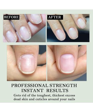 Nail Strengthener 12 ml | Protective and softening nail treatment | Nail1 Care Filler nourishing nail polish for healthy nail strengthening and daily manicure maintenance - Buy Online on GoSupps.com