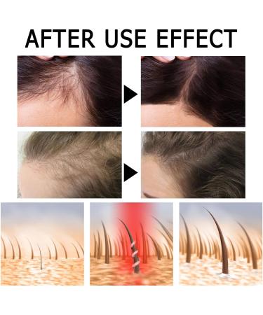 Lot de 14 ampoules de s rum capillaire pour la croissance et la r g n ration des cheveux - Huile hydratante pour cheveux fins ab m s secs mats et cassants - Buy Online on GoSupps.com