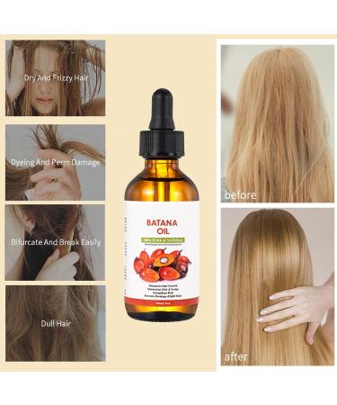 Batana Oil for Hair Growth Cold Pressed Batana Oil Strengthen Hair Moisturizing Scalp and Improve Breakage & Spilt Ends Hair Growth Oil for all Hair Types Leaves Your Hair Smoother Oil - Buy Online on GoSupps.com