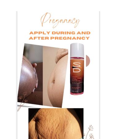 Natural Skincare Oil for Stretch Marks Scars & Dry Skin 125ML | All Skin Types | Anti-Aging & Uneven Tone Solutions - Buy Online on GoSupps.com