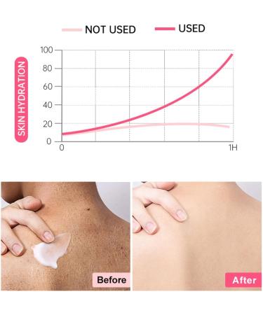 Body Exfoliator Moisturiser for Arms & Leg Skin Exfoliating Repair Cream Chicken Skin Care Cream Body Cream for Strawberry Legs Treatment - Buy Online on GoSupps.com