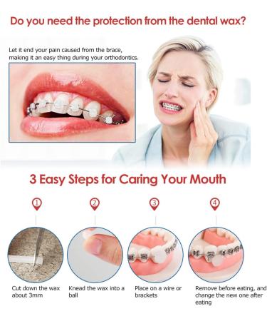 Xiyinli Tooth Wax for Orthodontic Pain Relief - 1 Pack 5 Stripes Rose Red - Ideal Oral Care for Braces Wearers - Buy Online on GoSupps.com