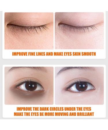 Vitamin C Eye Cream 15ml Dark Circle Eye Cream VC Eye Brightening Cream Firming Eye Cream Prevents Under Eye Bags And Puffiness - Buy Online on GoSupps.com