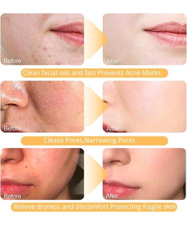 Vitamin C Face Wash with Brush Exfoliating Face Wash Gentle Foaming Cleanser for Oily Skin & Sensitive Skin Foaming Face Wash Women for Skin Tone Reduce Blemish & Acne Hydrate Skin Vegan 150ML - Buy Online on GoSupps.com