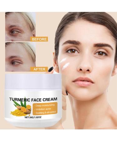 Fyearfly Turmeric face cream anti-aging cream relieves redness and swelling reduces pores moisturizing repair cream for daily care - Buy Online on GoSupps.com