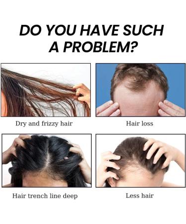 driattie Hair Growth Oil Natural Hair Essence Oil Hair Care Treatments with Concentrated Formula Natural Lightweight Nongreasy Hair Care Strengthens and Repairs Damage Before Use - Buy Online on GoSupps.com