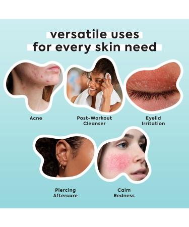 Hypochlorous Acid Spray for Face & Body - 3.4 fl oz 0.02% HOCL - Helps Reduce Redness and Breakouts - Travel Size Hypochlorous Spray - Multi-Purpose Topical Facial Skin Repair - pH-Balancing Toner 1 Count Hypochlorous Acid  - Buy Online on GoSupps.com