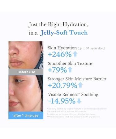 medicube Hydration Boost Facial Device Set: Hyaluronic Acid Moisturizing Jelly Cream and Booster Pro Black | For Radiant and Firmer-Looking Glow | Home Care Korean Skincare - Buy Online on GoSupps.com