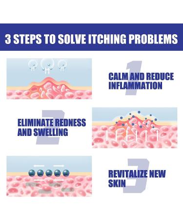 HEKEWER South Moon Psoriasis Repair Spray - Professional Herbal Treatment for Skin Plaque Psoriasis - Buy Online on GoSupps.com