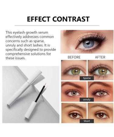 Eyelash Growth Essence - Longer Fuller Thicker Lashes | Mild Formula Eyelash Enhancement - Buy Online on GoSupps.com