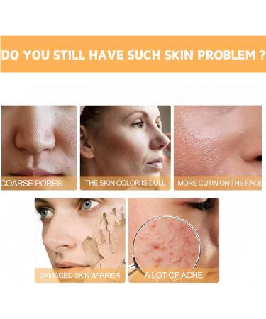 240ml Glycolic Acid 7% Toning Resurfacing Solution Glycolic Sour 7% Toner Skincare Hyaluronic Acid Serum for Large Pores & Acne Skin Resurfacing Solution Exfoliating - Buy Online on GoSupps.com