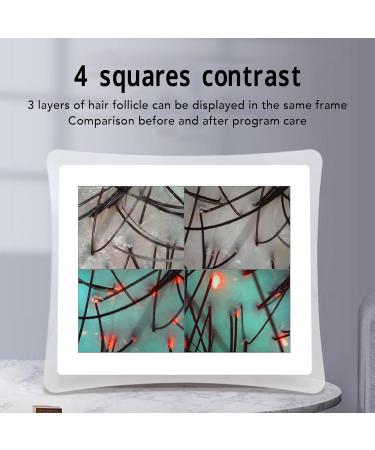 Skin Diagnosis Hair Analyzer 17 Inch 50X 200X Magnification LCD Screen Scalp Hair Follicle Hair Skin Analyser Machine 3 Light Modes Hair Follicle Detector for Home Salon Use - Buy Online on GoSupps.com