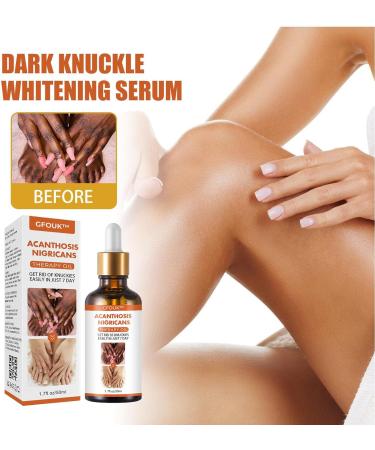 Skin Bleaching Serums | Dark Skin Permanent Whitening Lightening | Armpit Bleaching Serums for Women Supercharged Face Serums Skin Lightening Bleaching Oil Black Spot Corrector Remover for Face 2Pcs - Buy Online on GoSupps.com