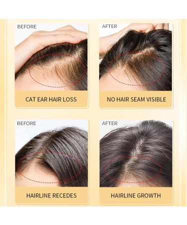 Vegan Natural Hair Growth Oil Vegan Hair Growth Oil Hair Oil Rosemary Hair Growth Oil For Dry Damaged Hair And Grow Thin Hair 2fl Oz 60 Ml 3 pcs - Buy Online on GoSupps.com