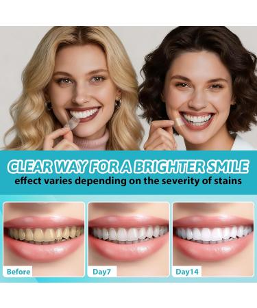 28 Bandes Blanchiment Dentaire Bandes Professionnel Des Dents Effective Blanchiment Dentaire Aide R duire Caf Soda Vin Tache Pour Un Sourire Radieux - Buy Online on GoSupps.com