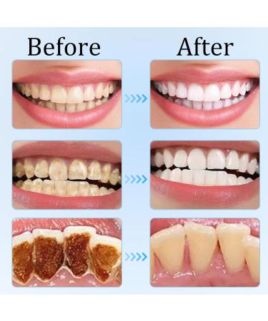 2pcs Niacinamide Teeth Whitening Toothpaste Nicotinamide Sparkling Toothpaste Removes Tea and Cigarette Stains Freshens Breath 100g*2 - Buy Online on GoSupps.com