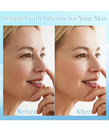 Micro Needling Kit for Face - Micro Infusion System for Face with Hyaluronic Acid & Collagen - Moisturizing & Anti-Wrinkle Facial Serum for All Skin Types - 1 Roller + 4 Serums - Buy Online on GoSupps.com