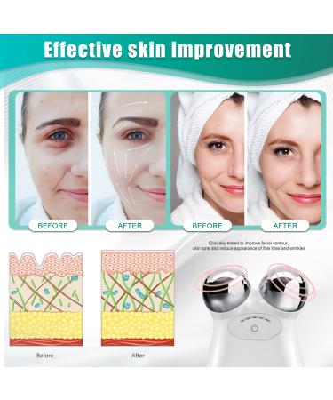 XIOGEZ Microcurrent Face Roller - Skin Tightening & Rejuvenation Spa Device for Wrinkle Remover - USB Mini Lift - Best Gift (White) - Buy Online on GoSupps.com