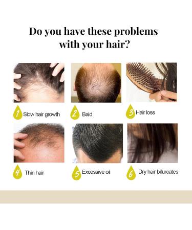 Handcrafted Rice Water & Aloe Vera Shampoo Bar for Hair Growth - 4.2oz - Buy Online on GoSupps.com