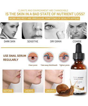 Snail Intensive Repair Serum Snail Mucin Essence Anti Wrinkle Collagen Serum Lifting & Anti Wrinkle Hydrating Face Serum Anti-aging Serum for Woman/Man Reduce Fine Lines Moisturiser - Buy Online on GoSupps.com