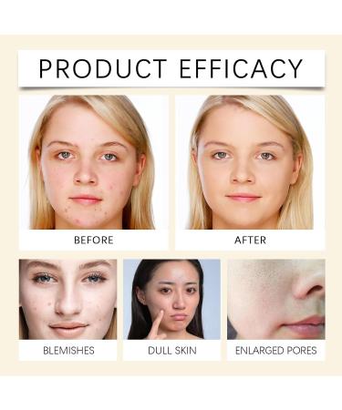 Nettoyant Visage Anti-points Noirs - Moussant Doux Hydratant En Profondeur Nourrissant Et For Une Peau Douce lastique(2PCS) - Buy Online on GoSupps.com