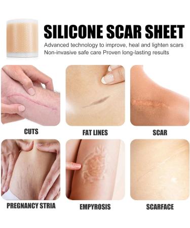 Teksome Scar Tape for Body - 1.5m Stretch Mark Remover Strips | Silicone Gel Tape for Scars & Stretch Marks - Buy Online on GoSupps.com