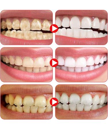 2 Pcs Sp-6 Fresh Breath Toothpaste Sp-6 Toothpaste Sp-6 Probiotic Toothpaste Probiotic Toothpaste Fresh Breath Toothpaste Removes Stains Complete Dental Care - Buy Online on GoSupps.com