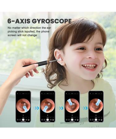 1296p HD WIFI Ear Wax Removal Otoscope | LED Camera Ear Cleaner for iPhone iPad & Android - Safe & Effective Cleaning - Buy Online on GoSupps.com