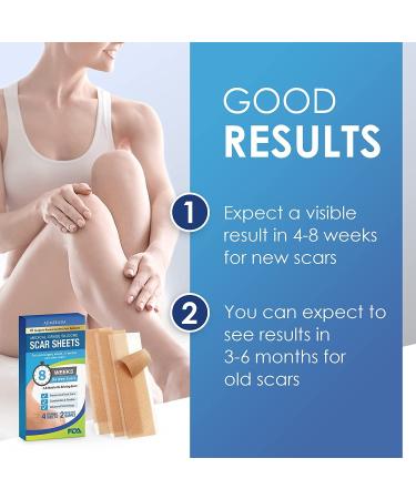 Scar Away Silicone Scar Sheets - Advanced Formula for Fast Scar Removal - 5.9*1.6'' Scar Tape Strips - Buy Online on GoSupps.com
