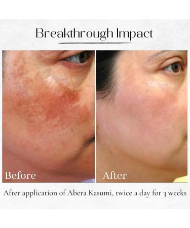 ABERA Kasumi Glowing Cream Hydrating Facial Moisturizer with Herbal Extracts Smoothing Effect (0.7 oz Each 3-Box Set) - Buy Online on GoSupps.com