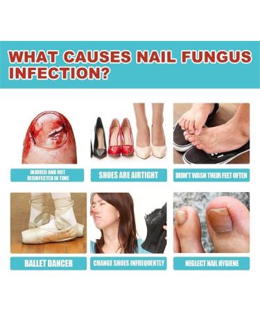 2024 New 3Boxes/48pcs Anti Fungus Nail Treatment Patches Toe Fungus Onychomycosis Repair Sticker Nail Patches - Buy Online on GoSupps.com