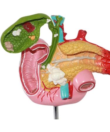 Duodenal Biliary and Pancreatic Model - Duodenal Model - Gallbladder Pathology Digestive System Model Tool Science Teaching Toy Model