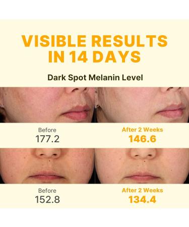 DERMACENTRIC 14-Day Vita Facial Ampoule Vegan Korean Skincare Serum with Niacinamide & Glutathione for Radiant Balanced-Looking Skin (1.01 fl oz) - Buy Online on GoSupps.com