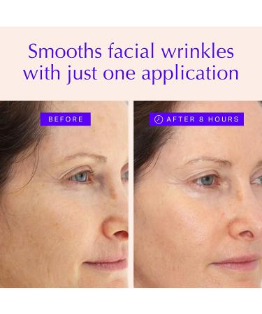Face & Forehead Wrinkle Patches - Anti Wrinkle Tape for Eye, Mouth, Forehead - Reduce Fine Lines Overnight - Botox Alternative (160 ct) - Buy Online on GoSupps.com
