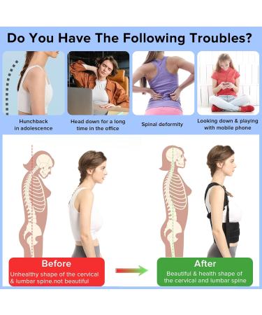 Lalent Back Support Brace Posture Corrector for Men and Women - Adjustable Upper Back Straightener Shoulder Lumbar Belt - Relief Pain in Neck Back and Shoulders (L) - Buy Online on GoSupps.com