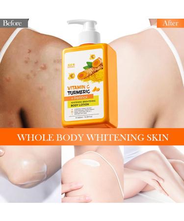  Utapossin Vitamin C and Turmeric Body Lotion - 300 ml - Brightening Body Lotion with Vitamin C for Beautiful Radiant Skin - Brightening Moisturizing Cream for Face and Body - Buy Online on GoSupps.com