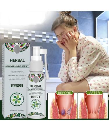 Natural Herbal Hemorrhoids Spray - Instant Relief for Piles Treatment and Anus Itch | Soothes Burning Pain, Shrinks Hemorrhoids - Buy Online on GoSupps.com