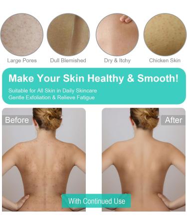 Yiclick Korean Peeling Gloves - Exfoliating Body Scrub Glove for Men & Women | Remove Dead Skin Easily - Buy Online on GoSupps.com