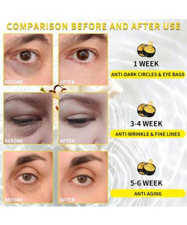 24K Gold Eye Mask Under Eye Gel Patches with Collagen - 60 Pieces | Reduce Puffiness, Dark Circles, and Wrinkles | Eye Bags Treatment - Buy Online on GoSupps.com