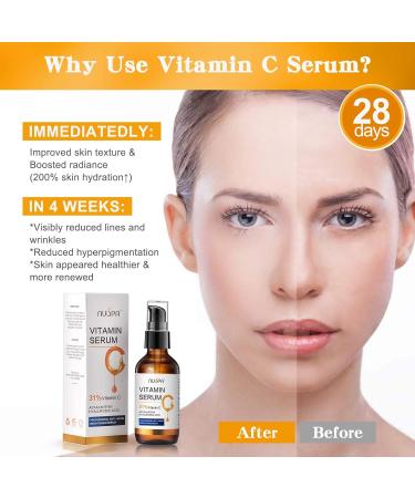 Vitamin C Serum for Face - 31% Anti-Aging Moisturizer with Hyaluronic Acid & Astaxanthin - Brightening & Age Spot Reduction - 2oz - Buy Online on GoSupps.com