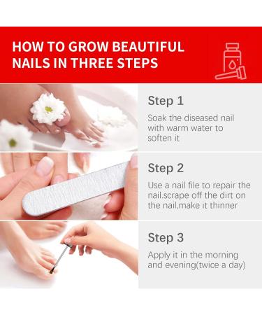 Extra Strength Toenail Fungus Treatment - 30ML Nail Solution with Soft Brush - Transform Your Nails & Boost Confidence - Buy Online on GoSupps.com