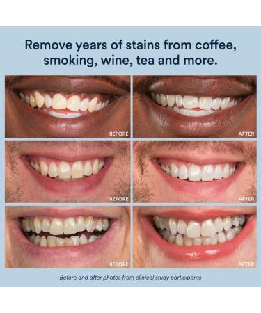 Auraglow Teeth Whitening Strips Peroxide Free 14 Treatments Whitens Teeth Without Sensitivity Natural Whitening Strips Removes Years of Stains Enamel Safe Teeth Whitener 28 Strips Mint - Buy Online on GoSupps.com